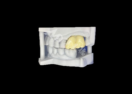 kopen Zware Zirconia tandheelkundige kroon Langdurige duurzaamheid gegarandeerde molen uit China tandheelkundig lab online manufacture