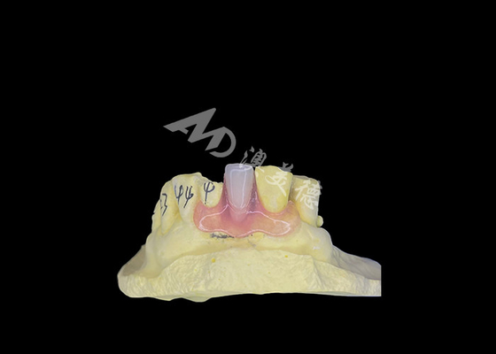 kopen Nesbit Flexible Partial Denture voor comfort en duurzaamheid bij tandvervanging online manufacture