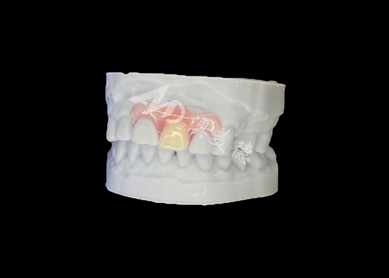 kopen Op maat gemaakte Nesbit Flexible Partial Prothesis voor natuurlijke pasvorm en langdurig comfort online manufacture
