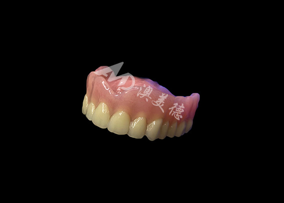 kopen Gepersonaliseerde volledige acrylprothese Gemakkelijk onderhoud Afneembare volledige boogprothese online manufacture