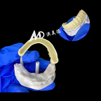 kopen Voorlopige implantaatbrug van PMMA met holle binnenkant voor stabiliteit en natuurlijke genezing, zeer nauwkeurige CAD/CAM-fabricage, biocompatibel PMMA-materiaal online manufacture