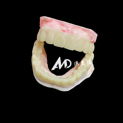 kopen Lightweight PMMA Temporary Bridges with Hollow Design for Implant Restorations online manufacture