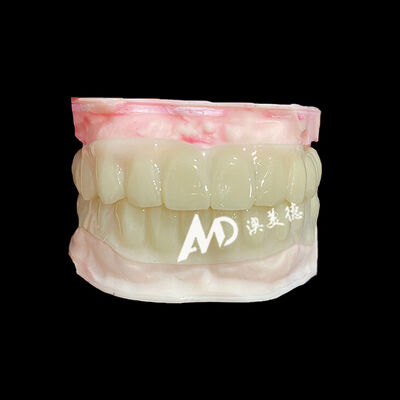 kopen PMMA Hollow Temporary Bridges for Implant Provisional Cases online manufacture