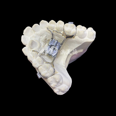 kopen Bereik precieze boogvergroting met onze orthodontische expander met kiezenbanden online manufacture