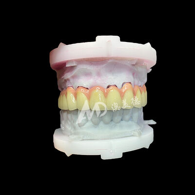 kopen Pure titanium keramische kroon en brug Duurzaam lichtgewicht Esthetische restauratie online manufacture