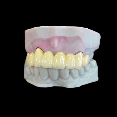 kopen Porselein-gesmolten-op-metaal (PFM) kroon met Co-Cr frame online manufacture