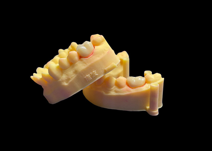 Premium Zirconia porseleinen tandkronen ongeëvenaarde sterkte Precisie pasvorm en uitzonderlijke esthetiek en duurzaamheid