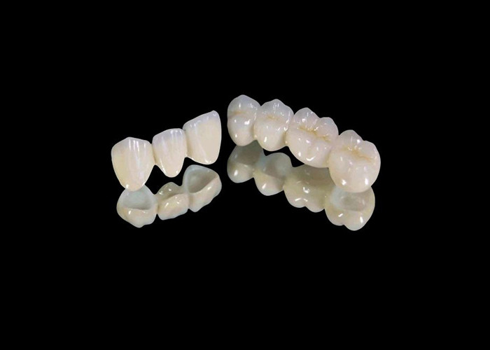 Versleten-bestendige circonia tandkroon met chips en vlekkenbestandheid en natuurlijke esthetiek uit China tandheelkundig lab