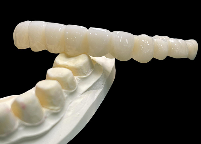 Vita Classical Shade All Ceramic Crown Bridge Natuurlijke op zoek naar tandheelkundige restauratie