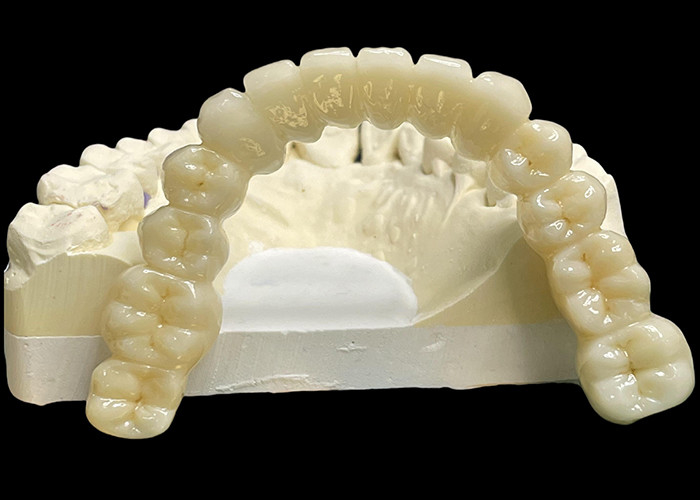 Vita Classical Shade All Ceramic Crown Bridge Natuurlijke op zoek naar tandheelkundige restauratie