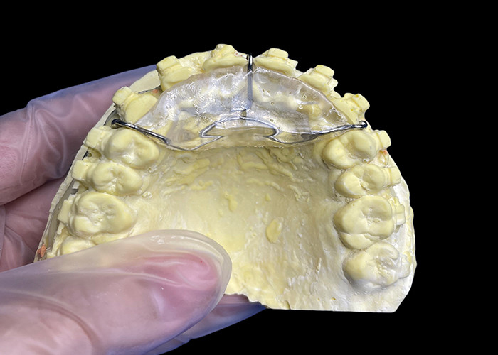 Op maat gemaakte orthodontische apparaten bijten vlak voor correcte bijten problemen of in TMJ verlichten van de druk op het kaakgewricht.