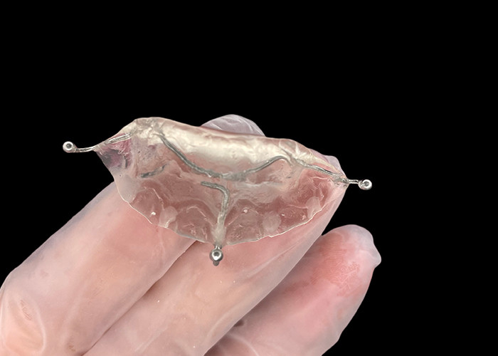 Op maat gemaakte orthodontische apparaten bijten vlak voor correcte bijten problemen of in TMJ verlichten van de druk op het kaakgewricht.