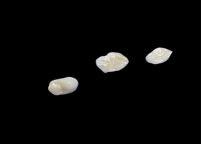 Biocompatibele keramische inlagen en onlays ontworpen voor comfortabele duurzaamheid en naadloze integratie met natuurlijke tanden