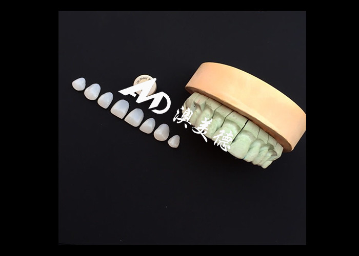 Transformeer je glimlach met IPS emax Press Porselein veneers Sterkte Esthetiek en duurzaamheid gecombineerd