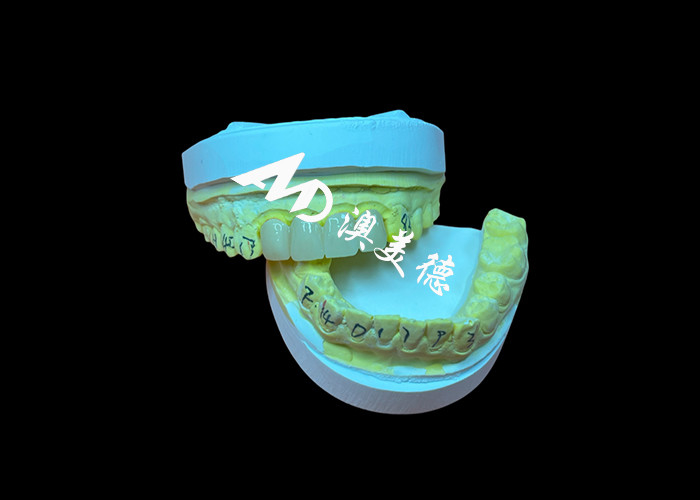 Tandheelkundige restauratie Translucent Zirconia Tandheelkundige kroon voor precieze pasvorm en natuurlijke esthetiek