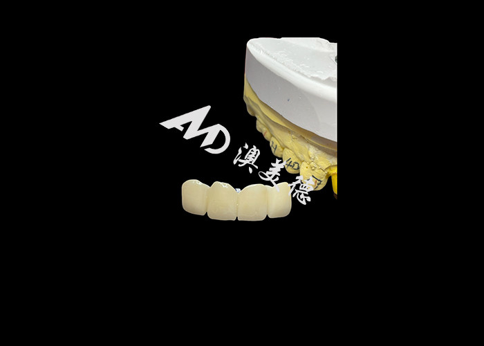 Tandheelkundige restauratie Translucent Zirconia Tandheelkundige kroon voor precieze pasvorm en natuurlijke esthetiek
