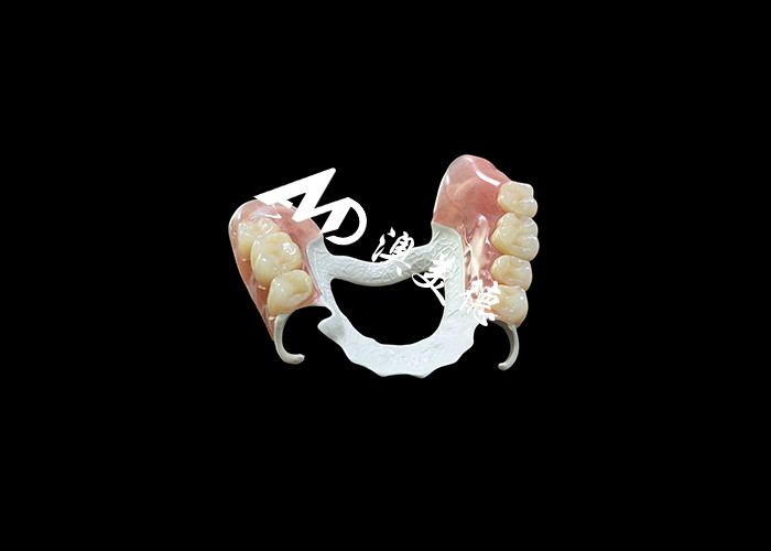 Afneembare prothese met HPP-frame en acrylbasis voor meer duurzaamheid en comfort