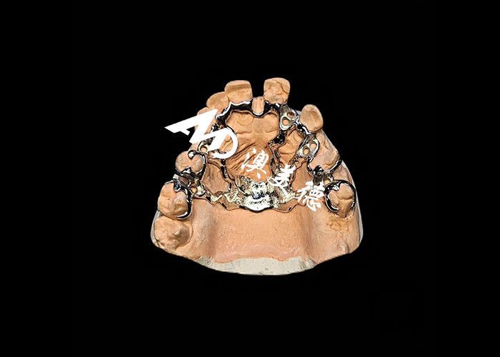 Afneembare tandheelkunde met gegoten metalen frame voor superieure sterkte en stabiliteit met langdurig comfort