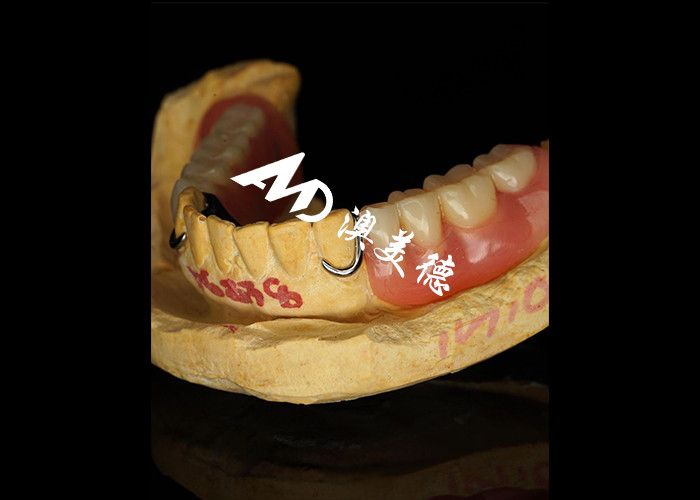Afneembare tandheelkunde met gegoten metalen frame voor superieure sterkte en stabiliteit met langdurig comfort