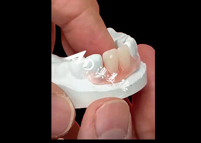 Nesbite-flexible prothesen bieden een naadloze oplossing voor een comfortabele en natuurlijke glimlach