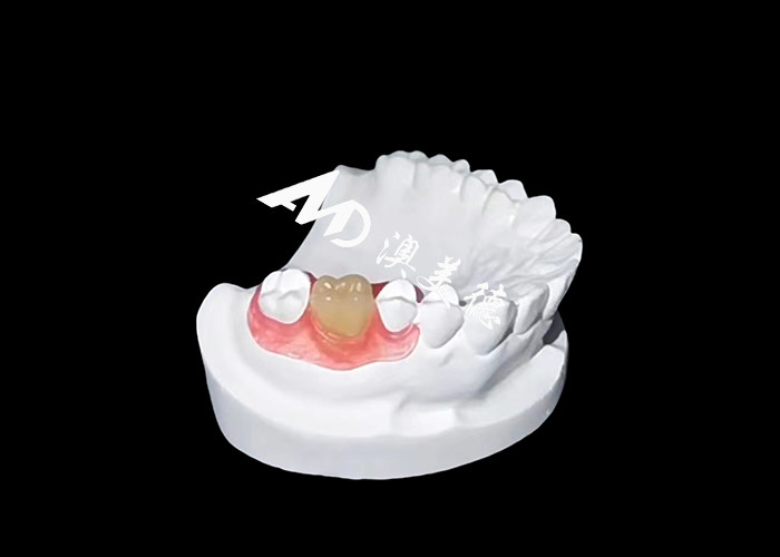 Nesbite-flexible prothesen bieden een naadloze oplossing voor een comfortabele en natuurlijke glimlach