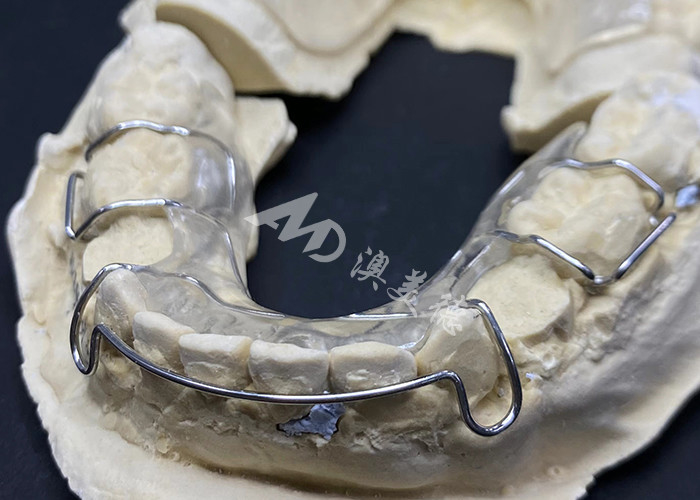 Comfortabel om te dragen de Hawley Retainer van AMD Dental Lab voor veilige en gezonde orthodontie