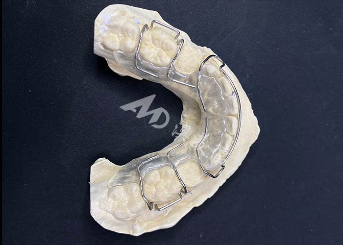 Hawley-houder Orthodontische apparaten voor comfortabele correctie van de tandbalans