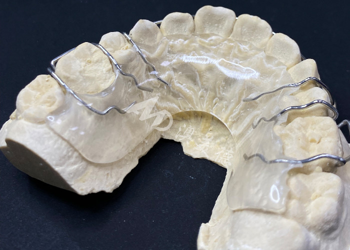 Hawley-houder Orthodontische apparaten voor comfortabele correctie van de tandbalans