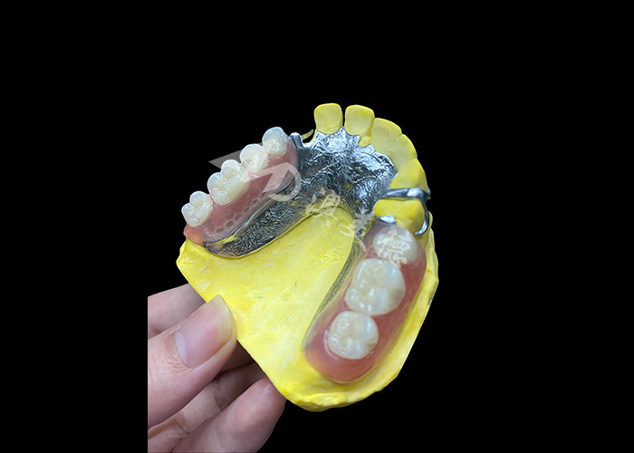 Verstelbare gesmolten gedeeltelijke gebit voor meer comfort en stabiliteit, perfect voor kauwen en spreken