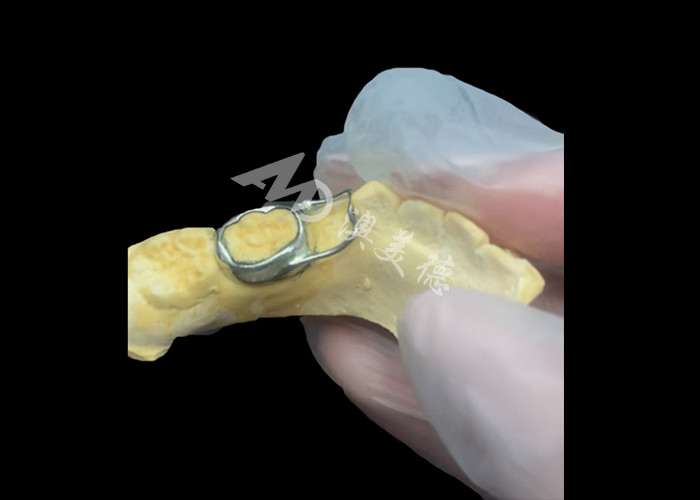 Orthodontic Space maintainer een onbetaalbaar apparaat dat ingenieus de tandkloof van kinderen beschermt en zorgt voor een goede tandontwikkeling.