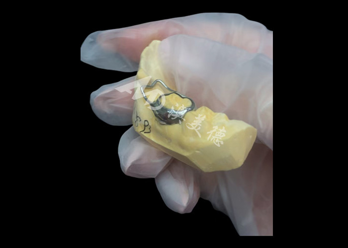 Orthodontic Space maintainer een onbetaalbaar apparaat dat ingenieus de tandkloof van kinderen beschermt en zorgt voor een goede tandontwikkeling.