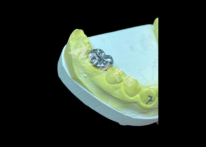 Langdurige functie Duurzame volledig metalen gietkroon voor superieure tandherstel