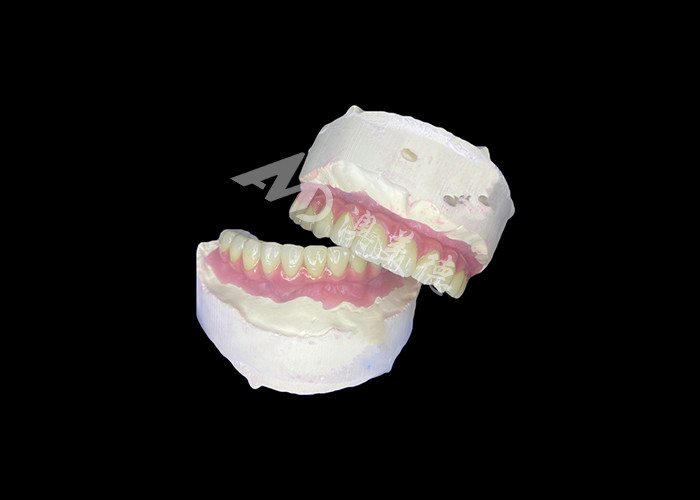 Dental All-on-6 tandheelkundige implantaten ondersteunde gebit met stabiliteit en comfort