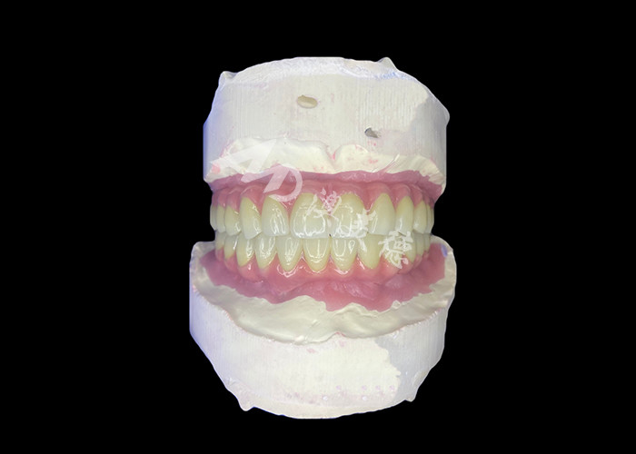 Dental All-on-6 tandheelkundige implantaten ondersteunde gebit met stabiliteit en comfort