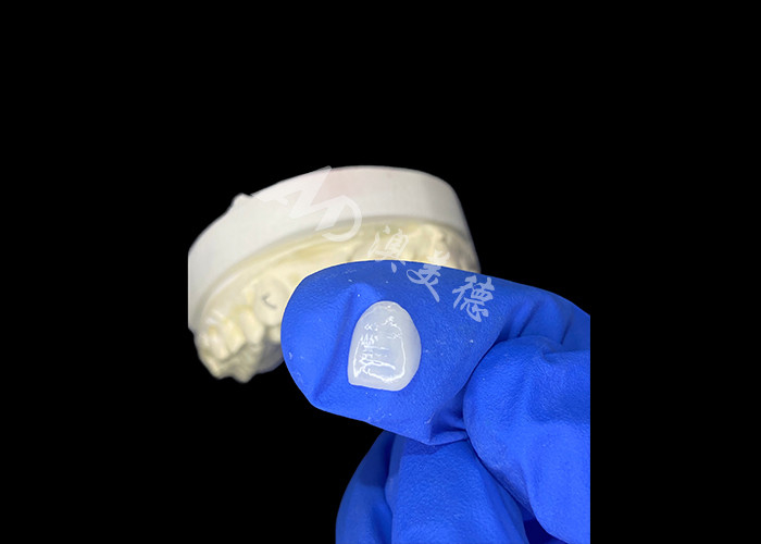 IPS e.max Finissen voor snijtanden in de kleur A1 Natuurlijke esthetiek voor een vlekkeloze glimlach