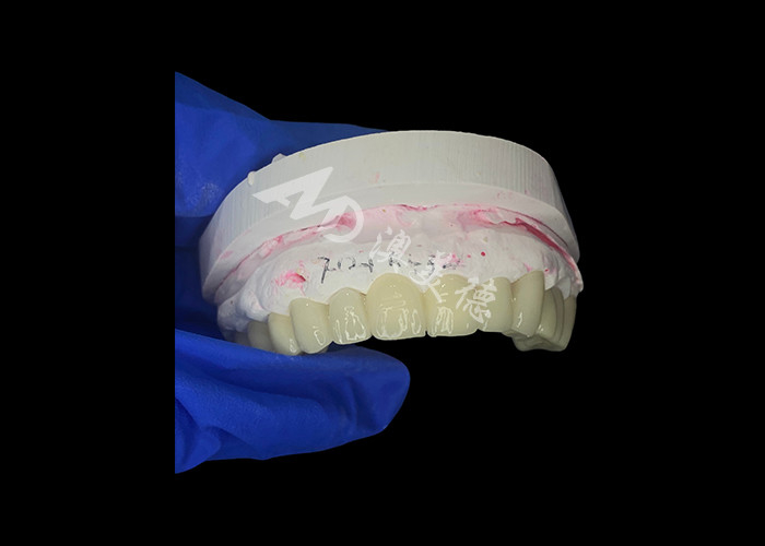 Hoge doorzichtigheid Zirconia Tandbrug Sterk en natuurlijk