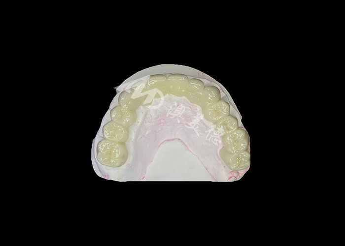 Hoge doorzichtigheid Zirconia Tandbrug Sterk en natuurlijk
