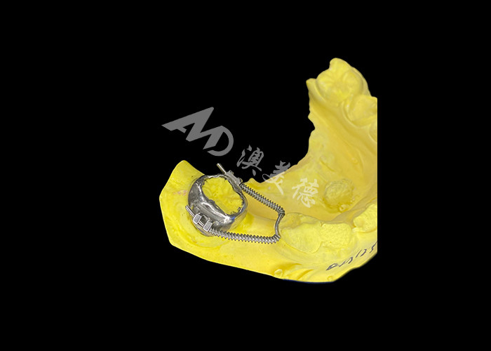 Schuiflusregainer voor effectief ruimteherstel en precieze tandbeweging om optimale uitlijning te bereiken bij orthodontische behandelingen