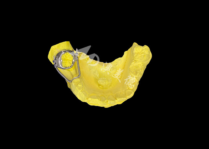 Schuiflusregainer voor effectief ruimteherstel en precieze tandbeweging om optimale uitlijning te bereiken bij orthodontische behandelingen
