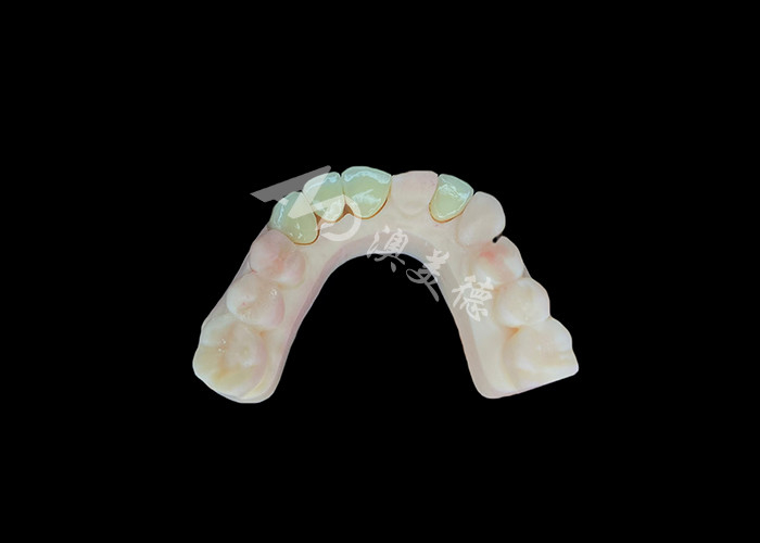 Natuurlijke en comfortabele fit Zirconia porseleinen kroon China tandheelkundig laboratorium aanpasbare schaduw