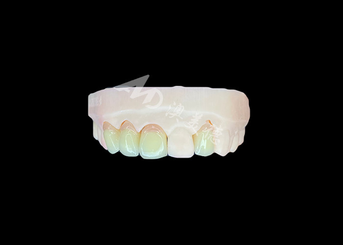 Natuurlijke en comfortabele fit Zirconia porseleinen kroon China tandheelkundig laboratorium aanpasbare schaduw