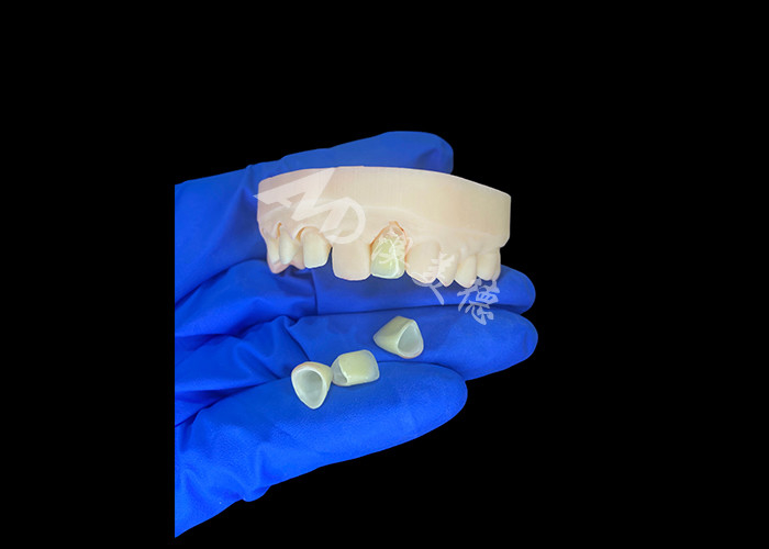 Natuurlijke en comfortabele fit Zirconia porseleinen kroon China tandheelkundig laboratorium aanpasbare schaduw