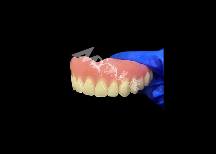 Full Arch Acrylic Prothesis Een betaalbare oplossing voor internationale vervangende protheses