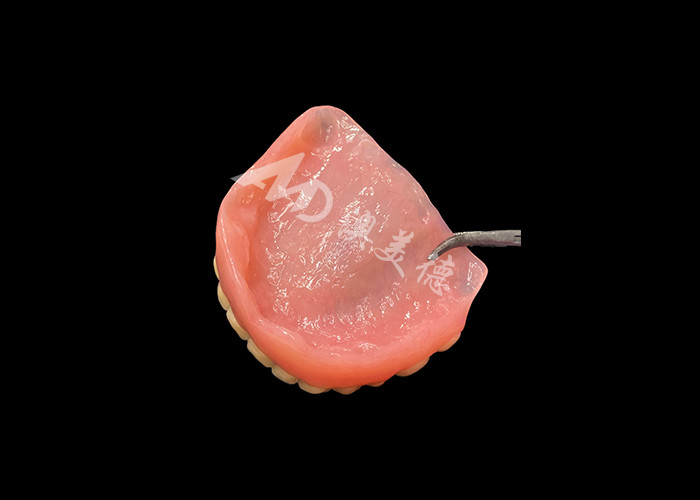 Full Arch Acrylic Prothesis Een betaalbare oplossing voor internationale vervangende protheses