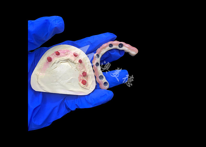 Titanium-abutment en circonia-kroonimplantaten ondersteunde gebitten Precision Fit voor comfortabel dragen