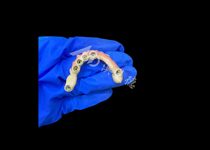 Titanium-abutment en circonia-kroonimplantaten ondersteunde gebitten Precision Fit voor comfortabel dragen
