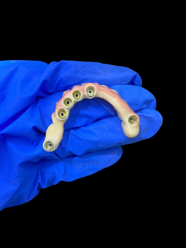 Titanium-abutment en circonia-kroonimplantaten ondersteunde gebitten Precision Fit voor comfortabel dragen