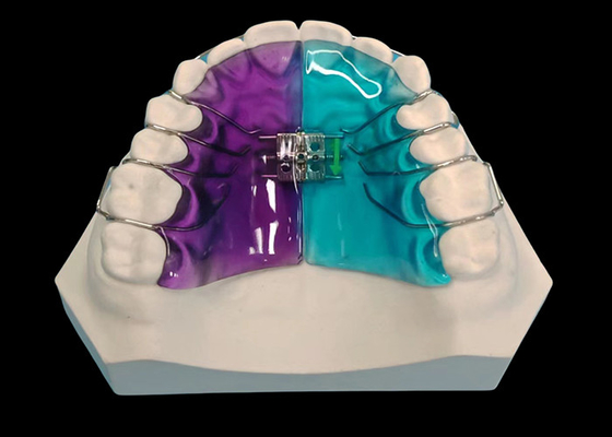 Goede prijs Afneembare expander voor effectieve orthodontische behandeling en glimlachverbetering online