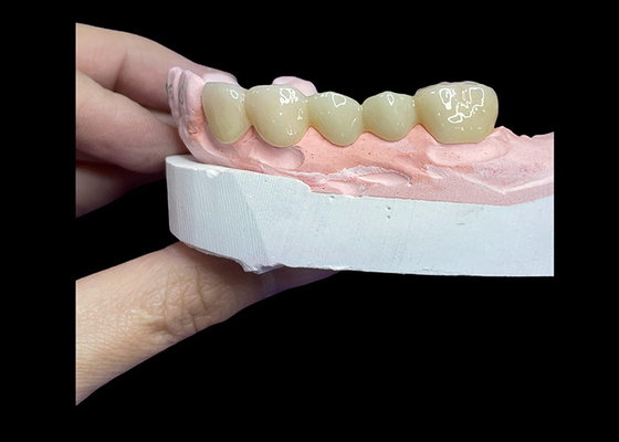 Goede prijs Alle keramische kronen en bruggen zijn ontworpen voor superieure esthetiek, duurzaamheid en natuurlijke pasvorm voor langdurig vertrouwen. online