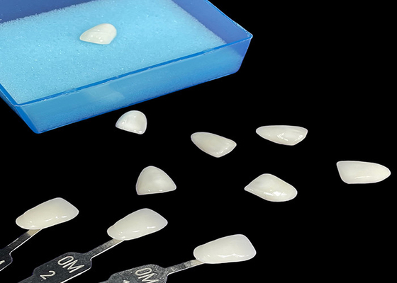 Goede prijs Porselein Emax Veneer Translucent Bonding voor precieze esthetische restauratie online